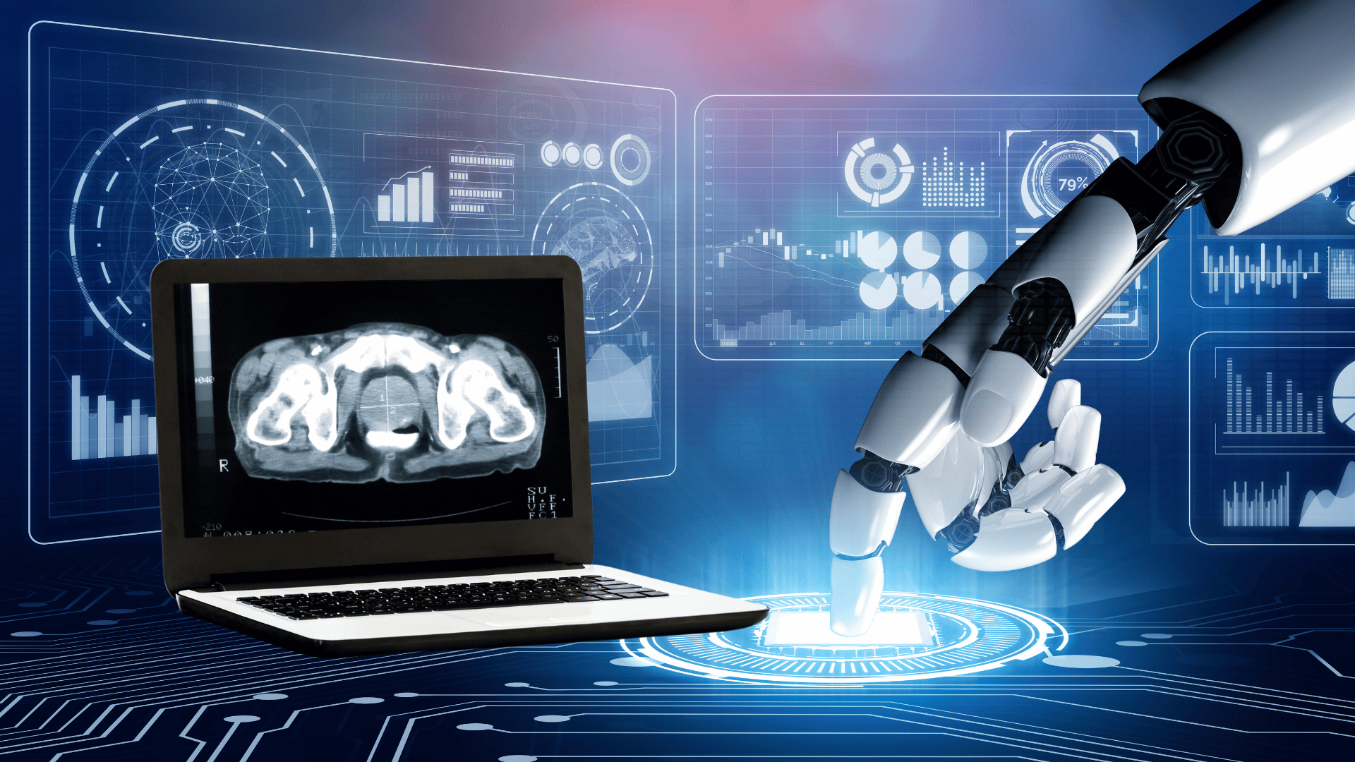 Uso del machine learning para predecir la progresión del cáncer de próstata