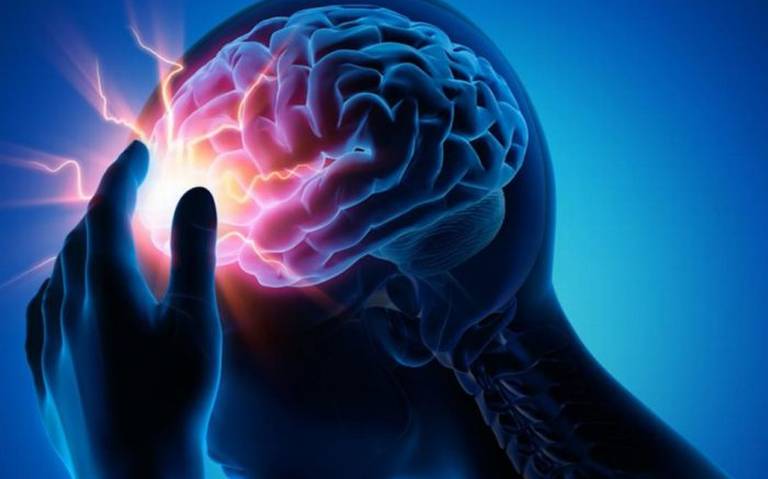 El Infarto cerebral podría convertirse en una de las primeras causas de muerte en México