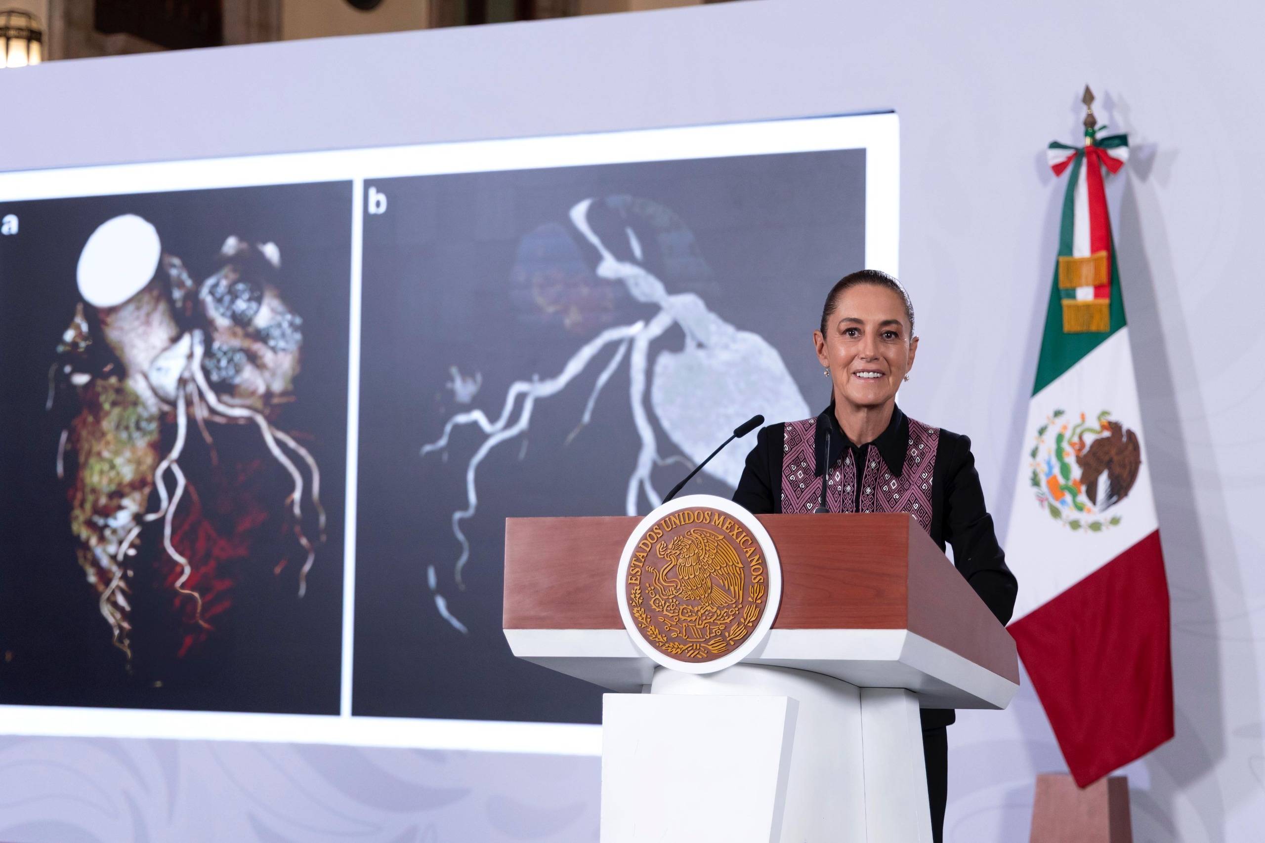 ESTAMOS RESARCIENDO LOS DAÑOS DEL NEOLIBERALISMO CON SALTO TECNOLÓGICO EN EL IMSS, IMSS BIENESTAR E ISSSTE: PRESIDENTA CLAUDIA SHEINBAUM